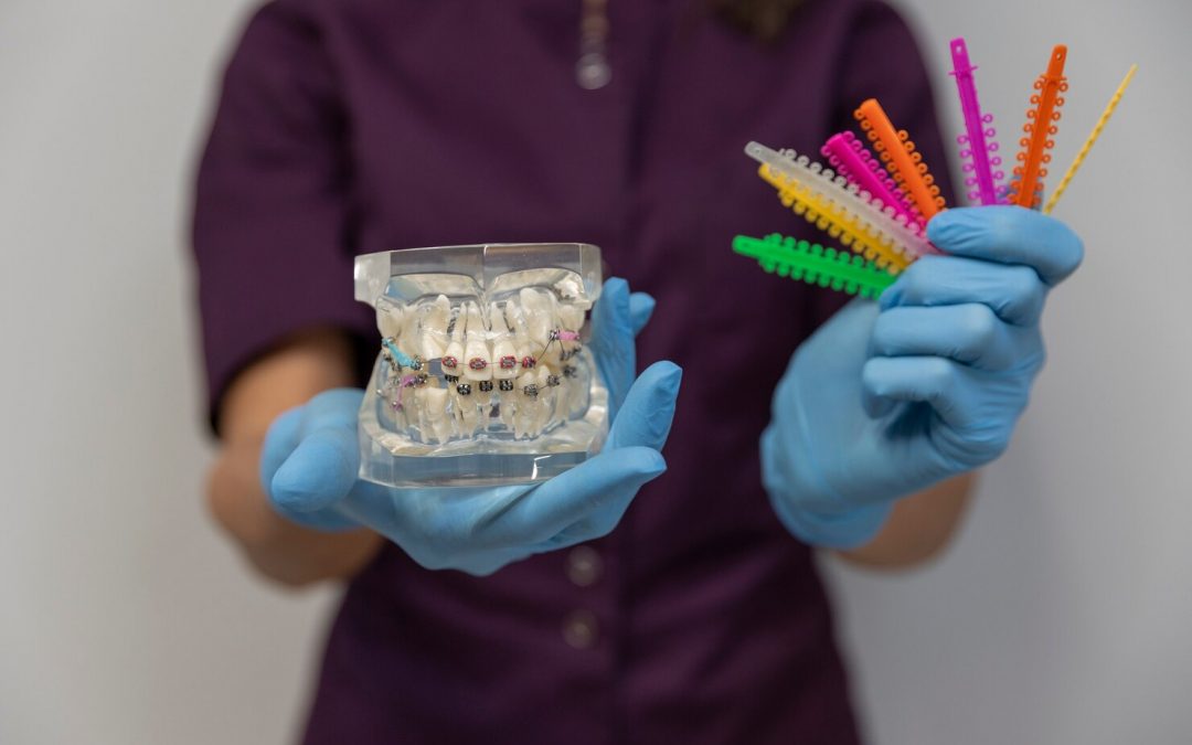 Transforma Tu Sonrisa: Los Mejores Tratamientos de Ortodoncia